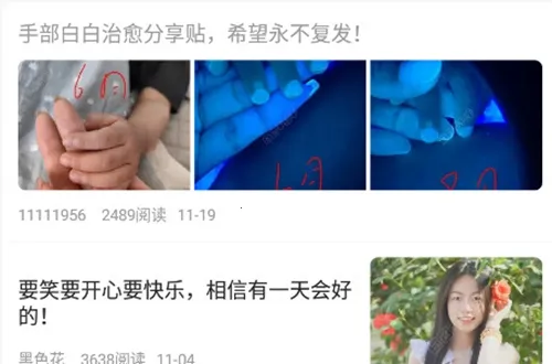 白白手拉手(白癜风交流平台) 白白手拉手(白癜风交流平台)